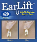 Earring Support Patches 7 Pack P7882